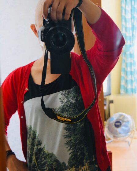 抗がん剤で髪が抜けた私